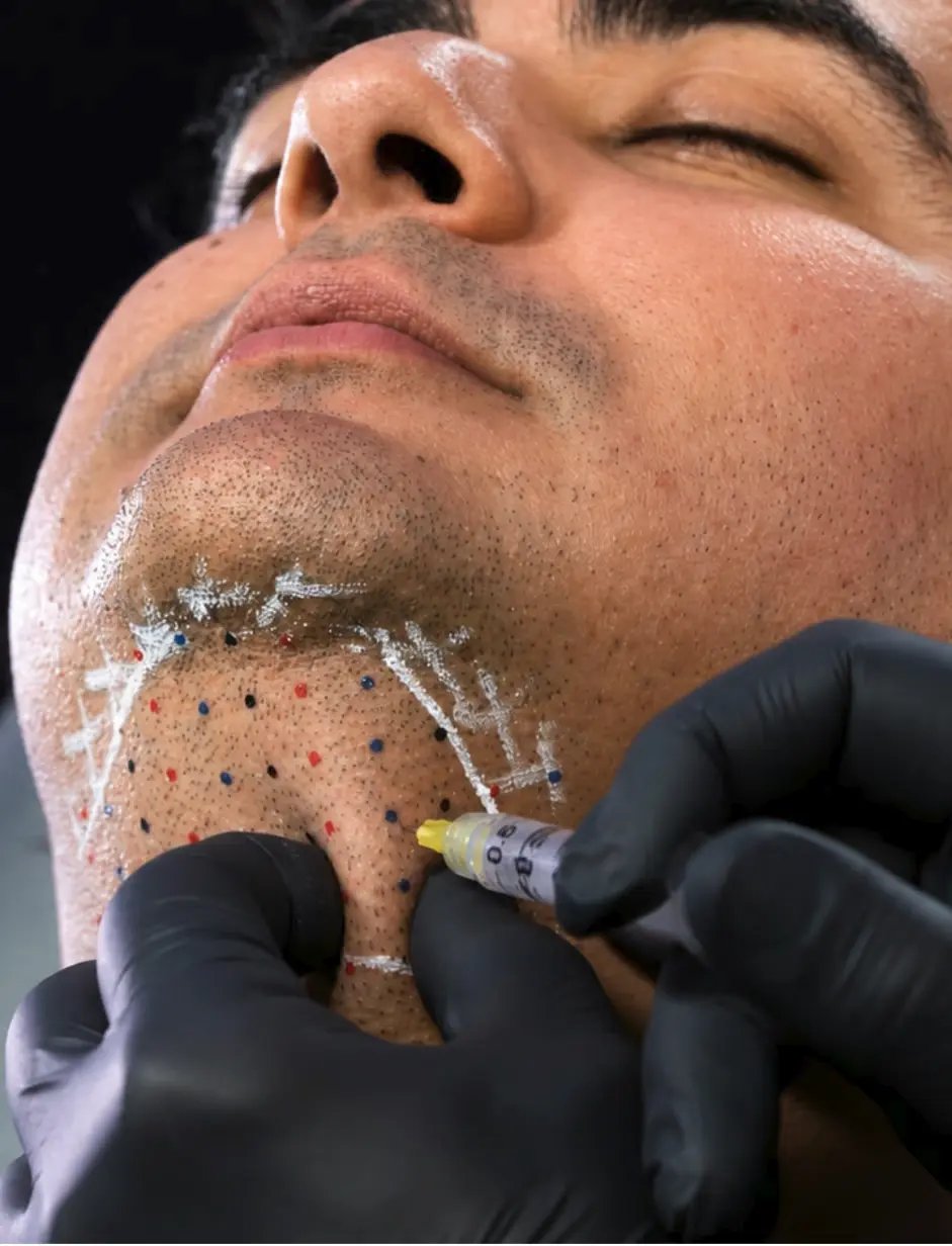 Kybella® Certification & Injection Training