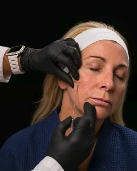 pdo thread lift training level I & II background portrait