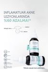 The Purest Solutions Siyah Nokta ve Sivilce Karşıtı Niacinamide Cilt Bakım Serumu 30 Ml (niacinamide 5% & Zinc Pca 1%)