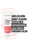 Neutrogena Sivilce Karşıtı % 4 Niasinamid + Pantenol Jel Nemlendirici 50 Ml