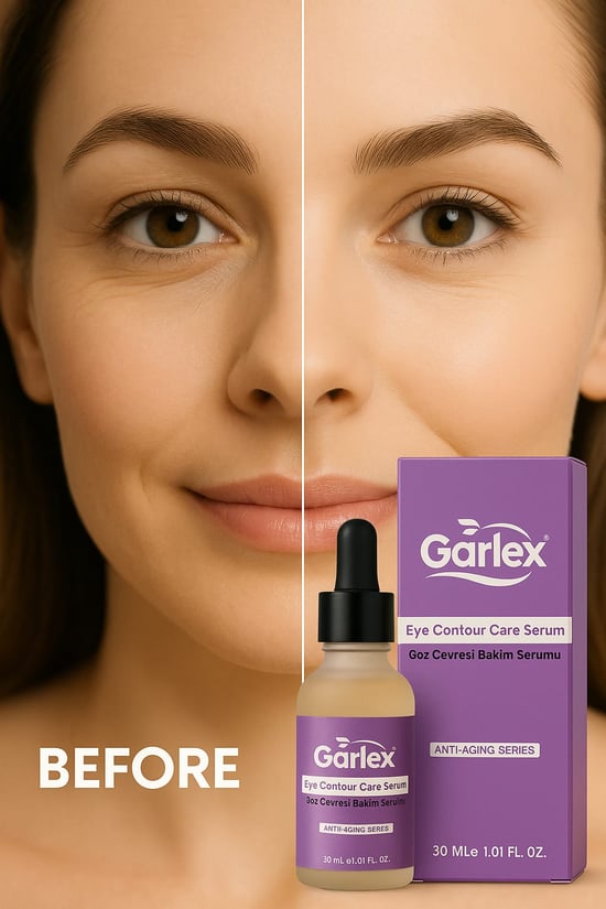 Göz Çevresi Bakım Serumu 30 Ml