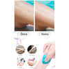 Epilator ( Kristal ) Tüy Alma Epilatörü