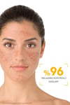 Bioderma Photoderm Leke Karşıtı Güneş Kremi Spf 50+ Golden 40 Ml