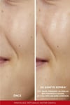 L'oreal Paris Revitalift Koyu Leke Karşıtı Peeling Etkili Tonik 180 Ml