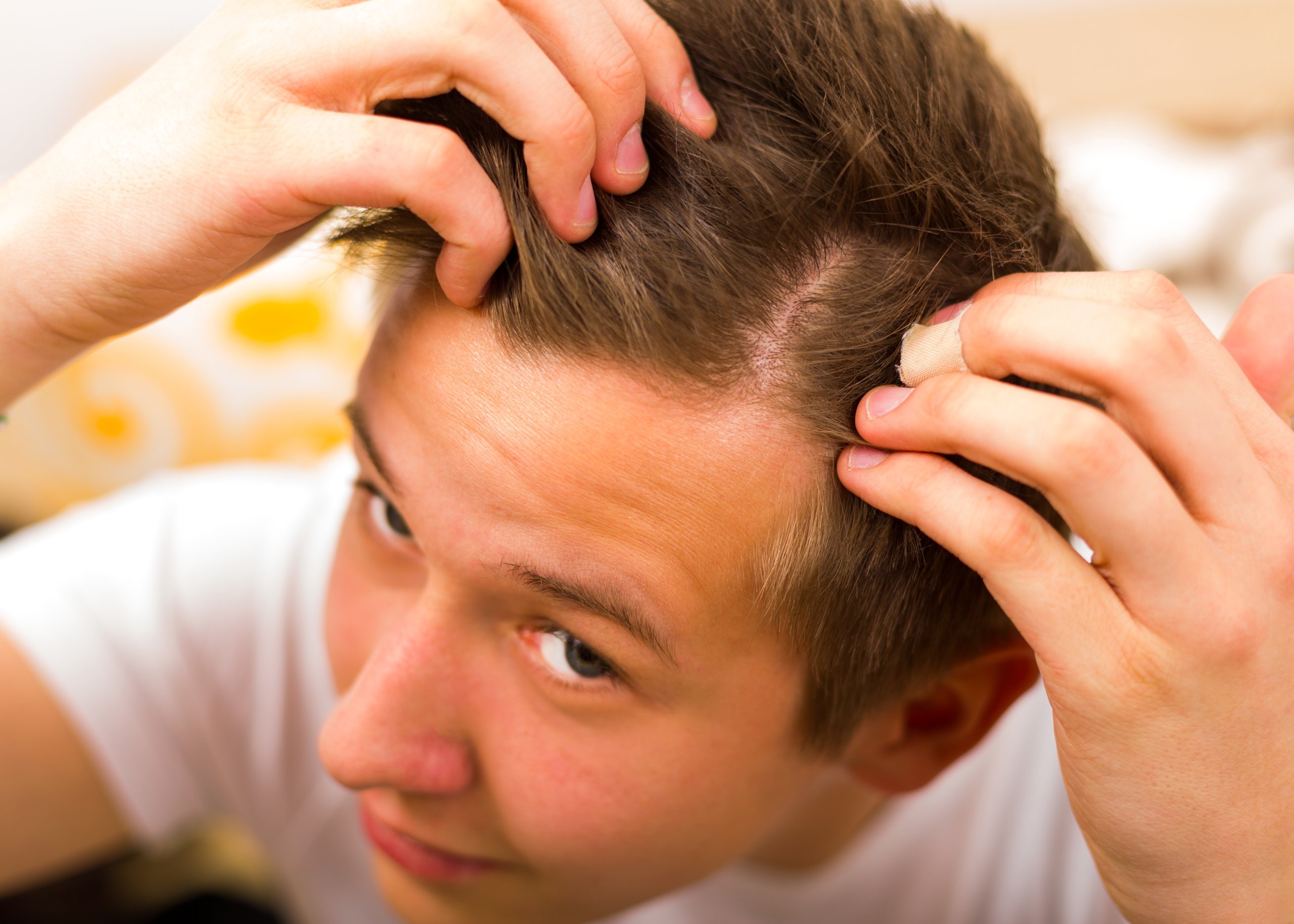 lozioni per capelli
