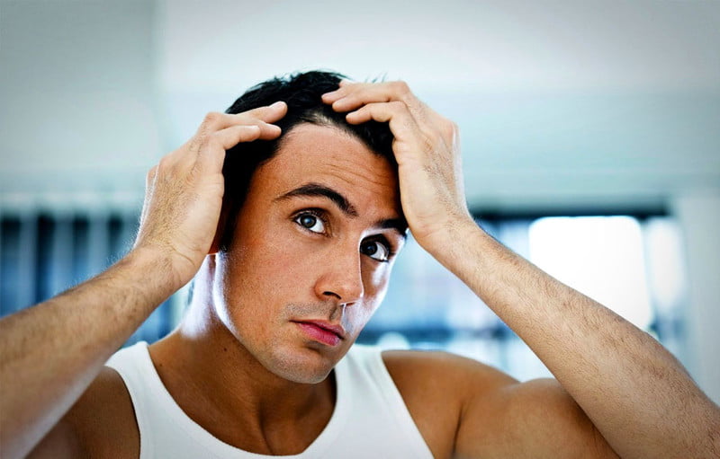 caduta capelli
