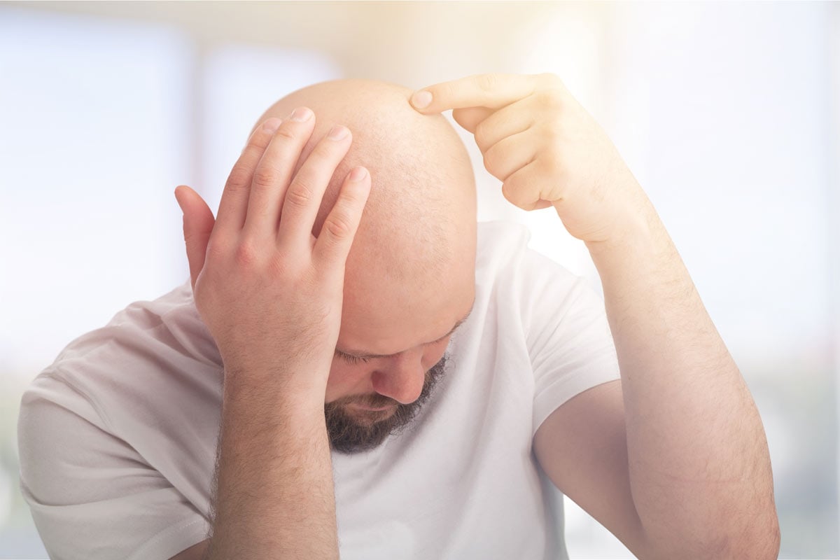 cause alopecia universale