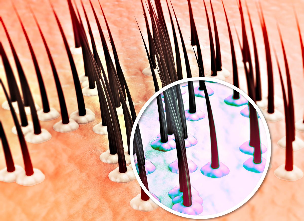 anomalie capelli