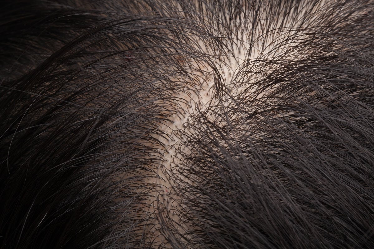 capelli ruvidi