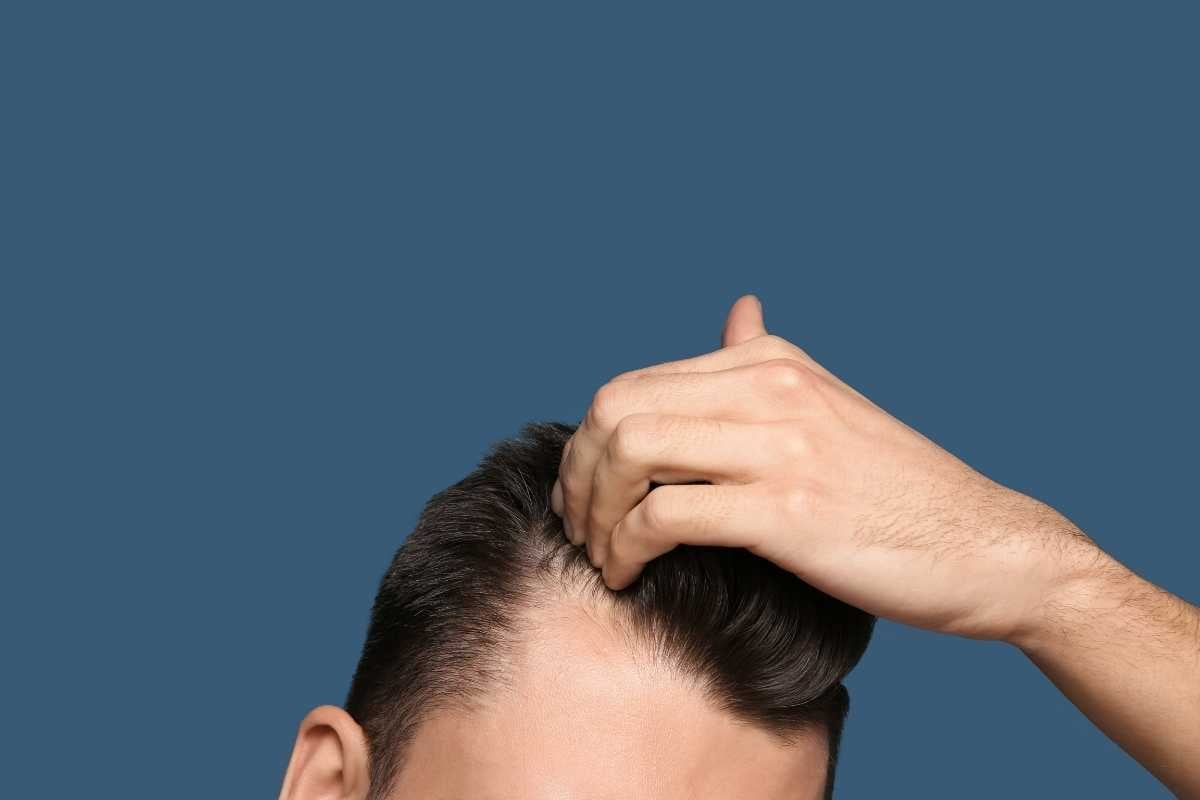 coem smaltire alcol nei capelli