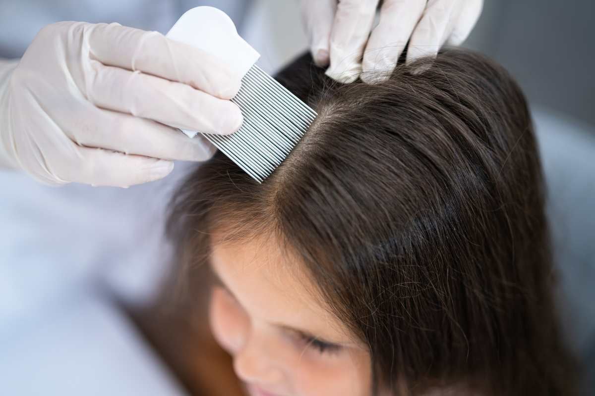 alopecia infantile