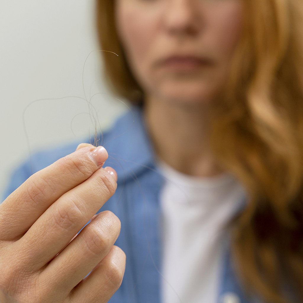 Caduta dei capelli stagionale donna
