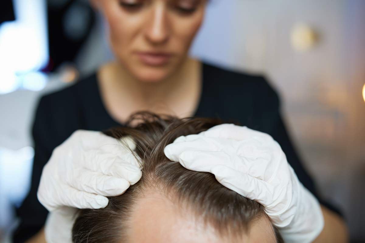 densità dei capelli