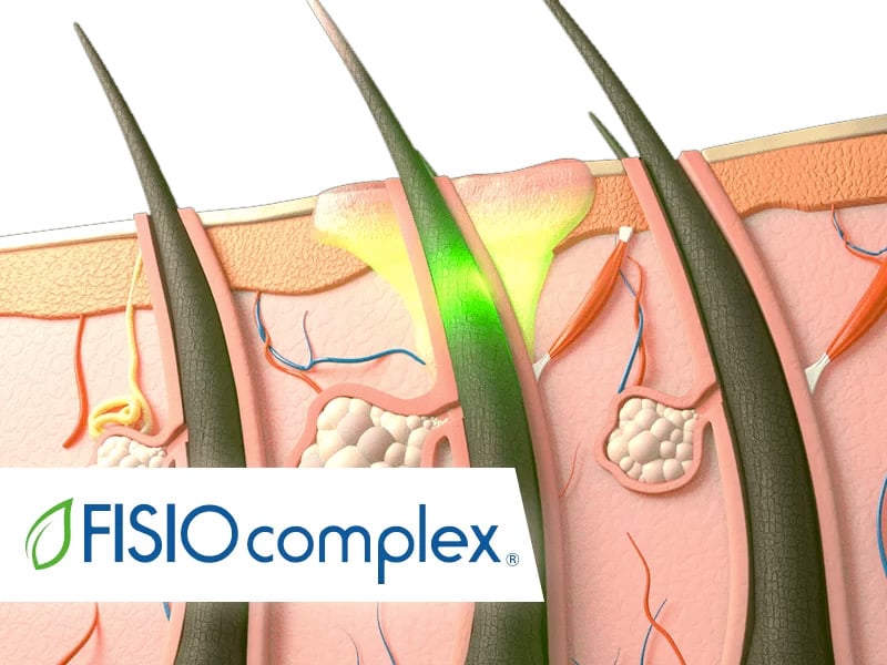 calvizie precoce soluzioni fisio complex