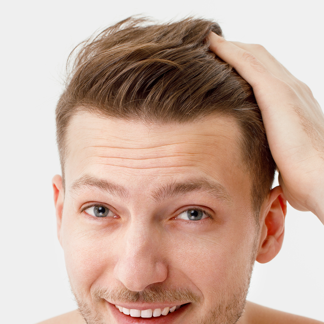 Normalizzazione della caduta dei capelli