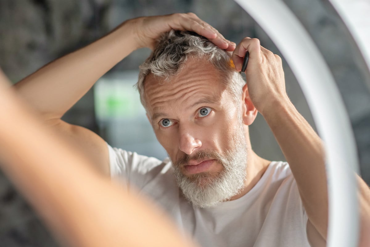 FUE (Follicular Unit Excision): la tecnica avanzata per il trapianto di capelli, barba e sopracciglia