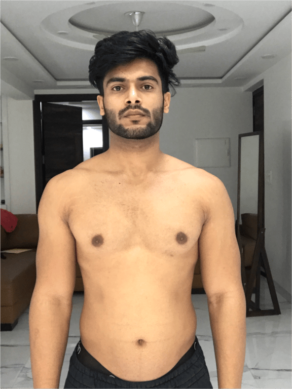 Gaurav before transformation
