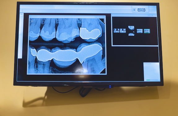 digitalxrays X-rays