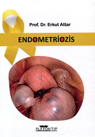 Endometriozis