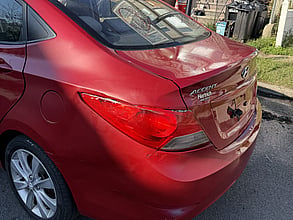 2014 Hyundai Accent