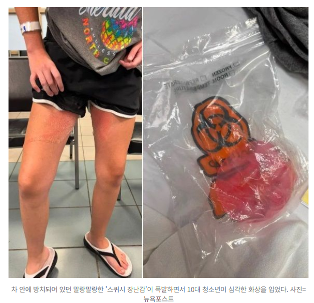 "순식간에 폭발해 화상"...한여름 차 안에 '이 장난감' 절대 두지 마세요 1