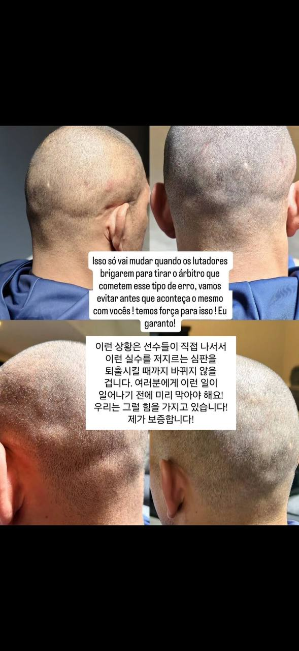 재경기를 원하는 페레이라 ㄷㄷㄷ 2