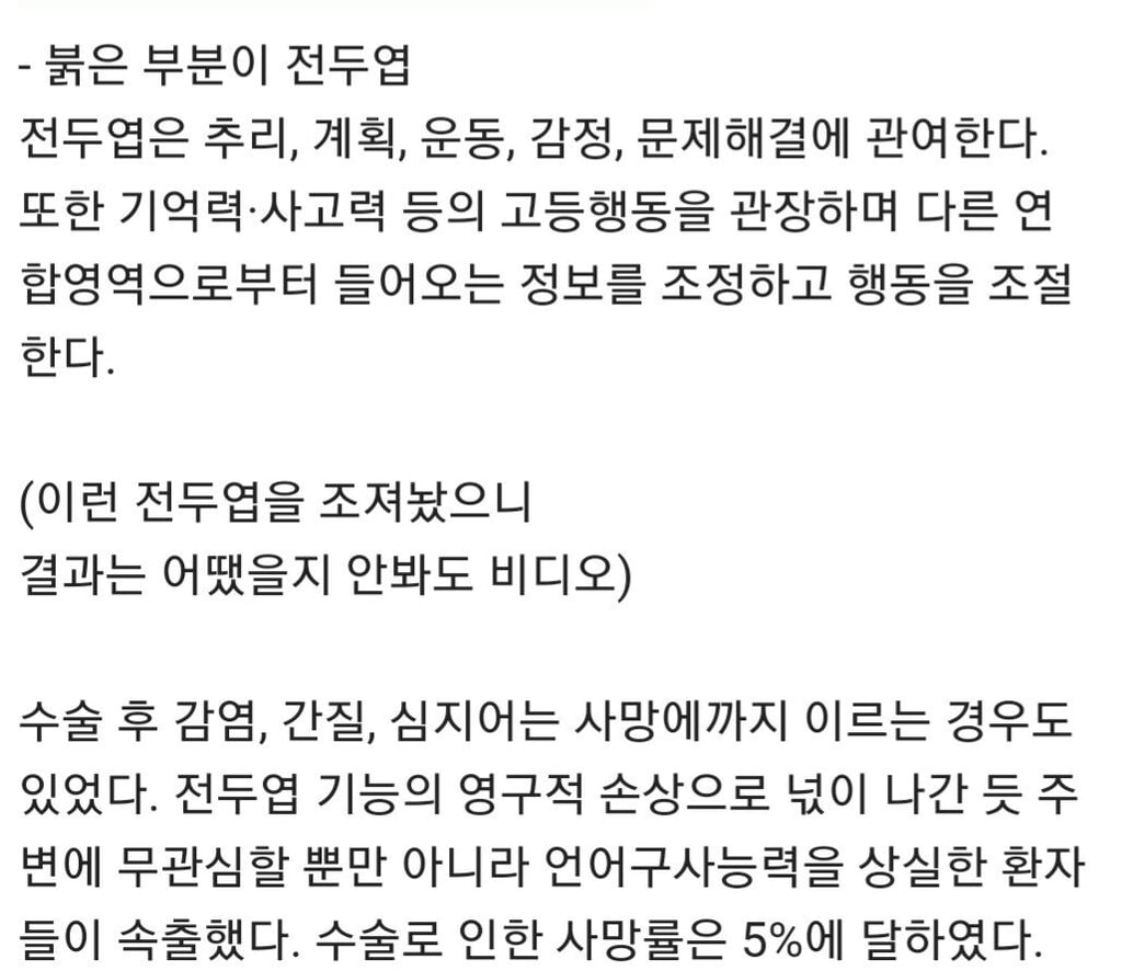 검증되지 않은 뇌 전두엽 제거 수술받은 케네디가 불행한 여인 12