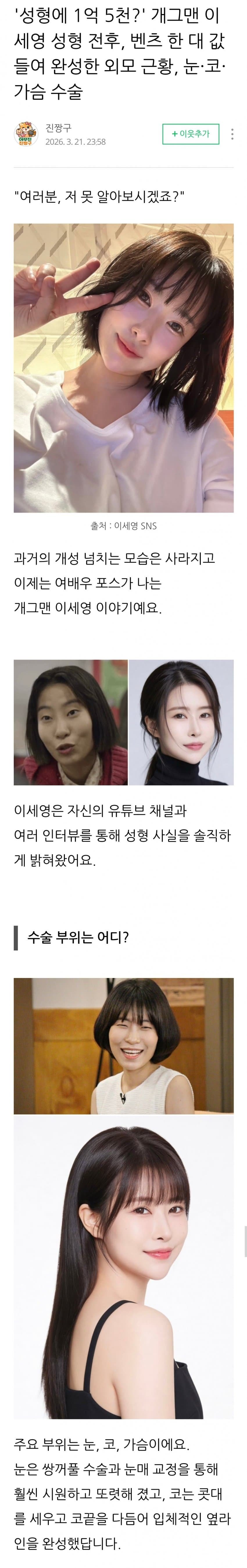 성형에 1억5천쓴 개그우먼 3