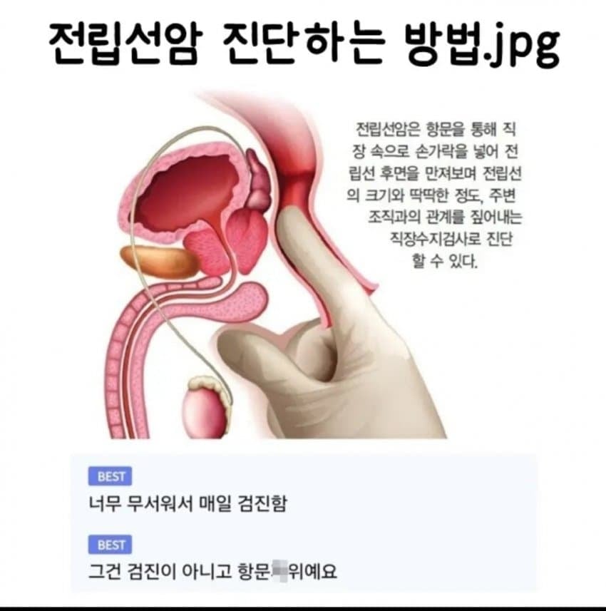 무서워 매일매일 검진해야하는것