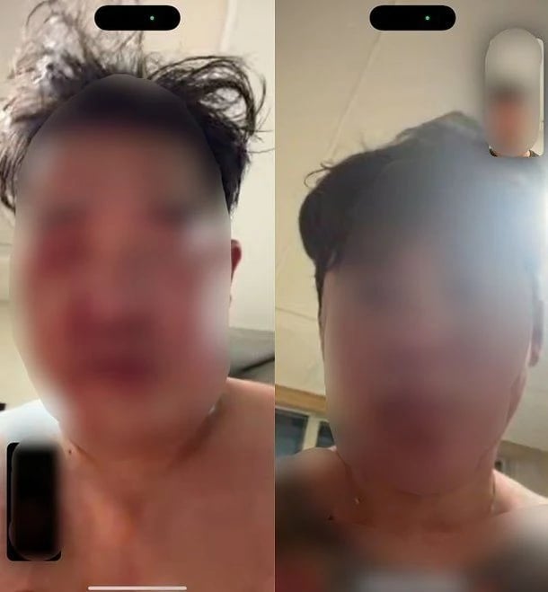 '피범벅 나체' 살인범 마주치고도…경찰, 바로 검거 못했다 3