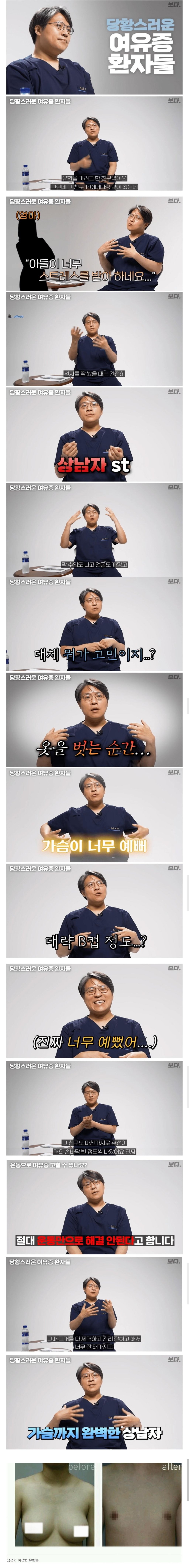 ㅇㅎ 의사를 당황시킨 여유증 환자