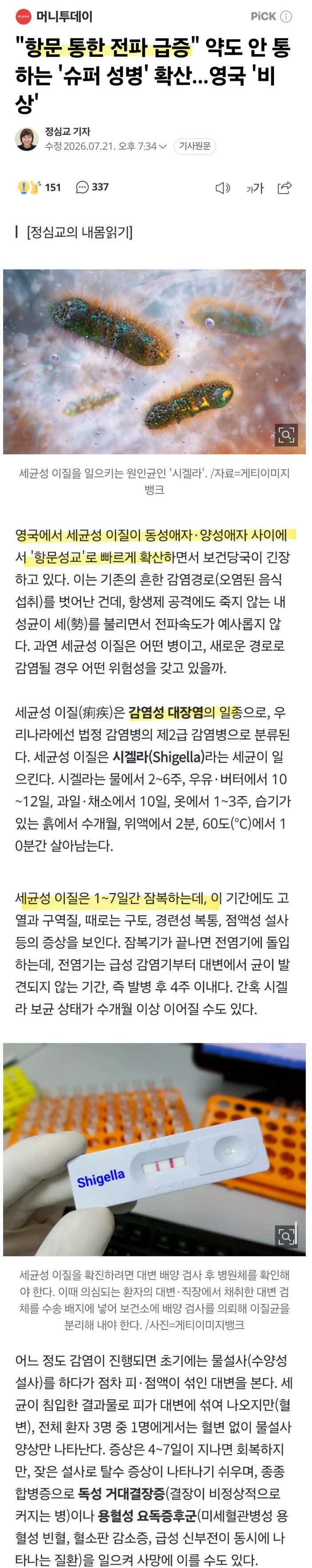 짱구야