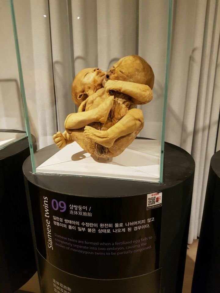 혐주의) 현대사회에선 절대 전시 불가능했을 전시전 ㄷㄷ 14