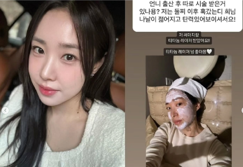 한국 연예인들이 활동 휴식기 동안 받다는 시술 1