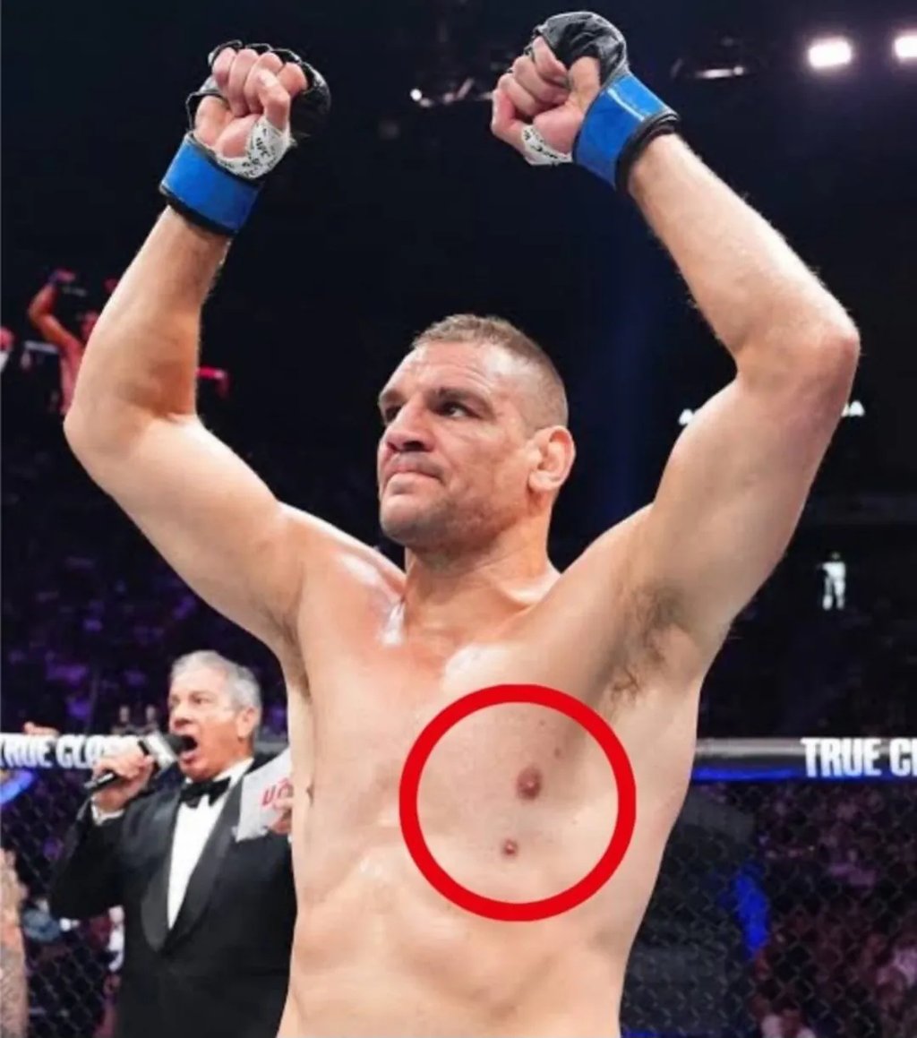 약혐) UFC 삼유두 레전드 3