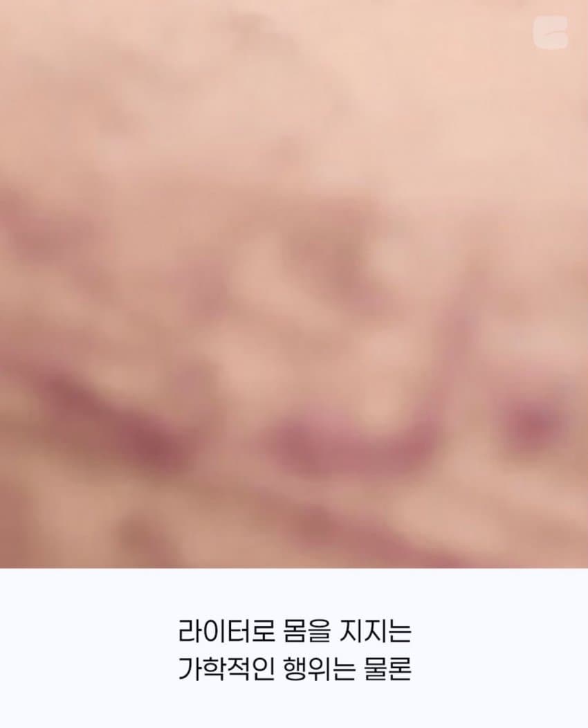 모두가 잊고있던 사건 ㄷㄷ 5