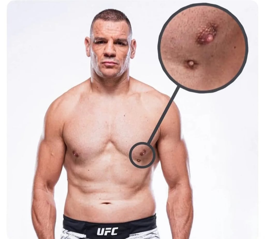 약혐) UFC 삼유두 레전드 2