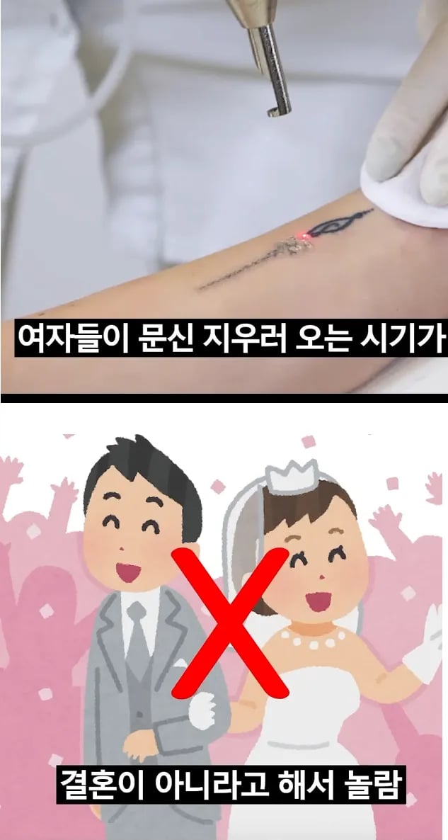 여자들이 문신 지우는 의외의 시기 1위 2