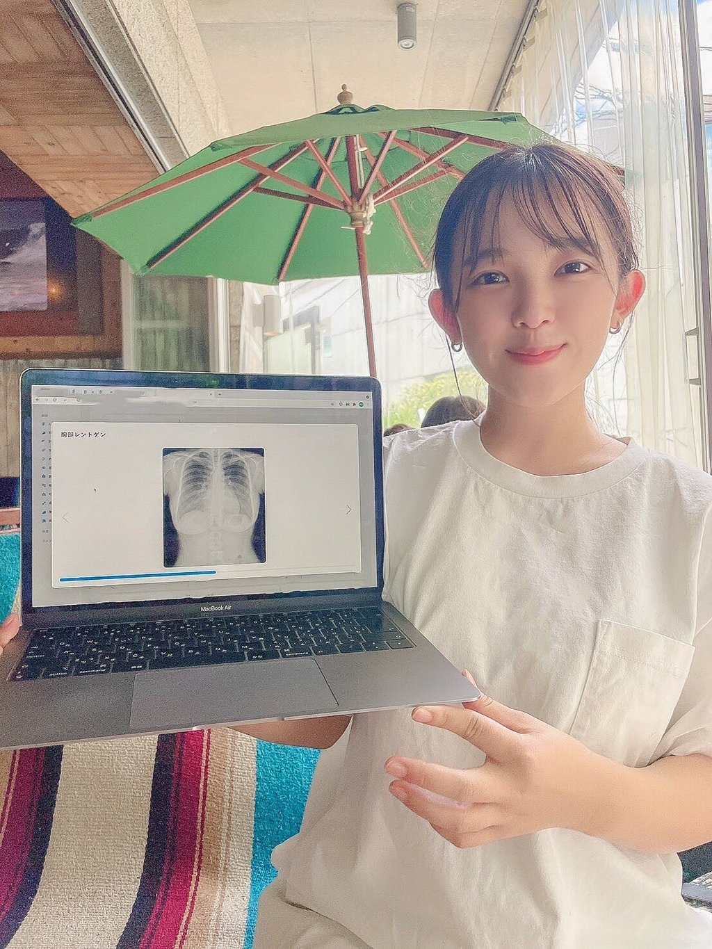가슴 진짜라고 엑스레이 공개한 그라비아 처자 1