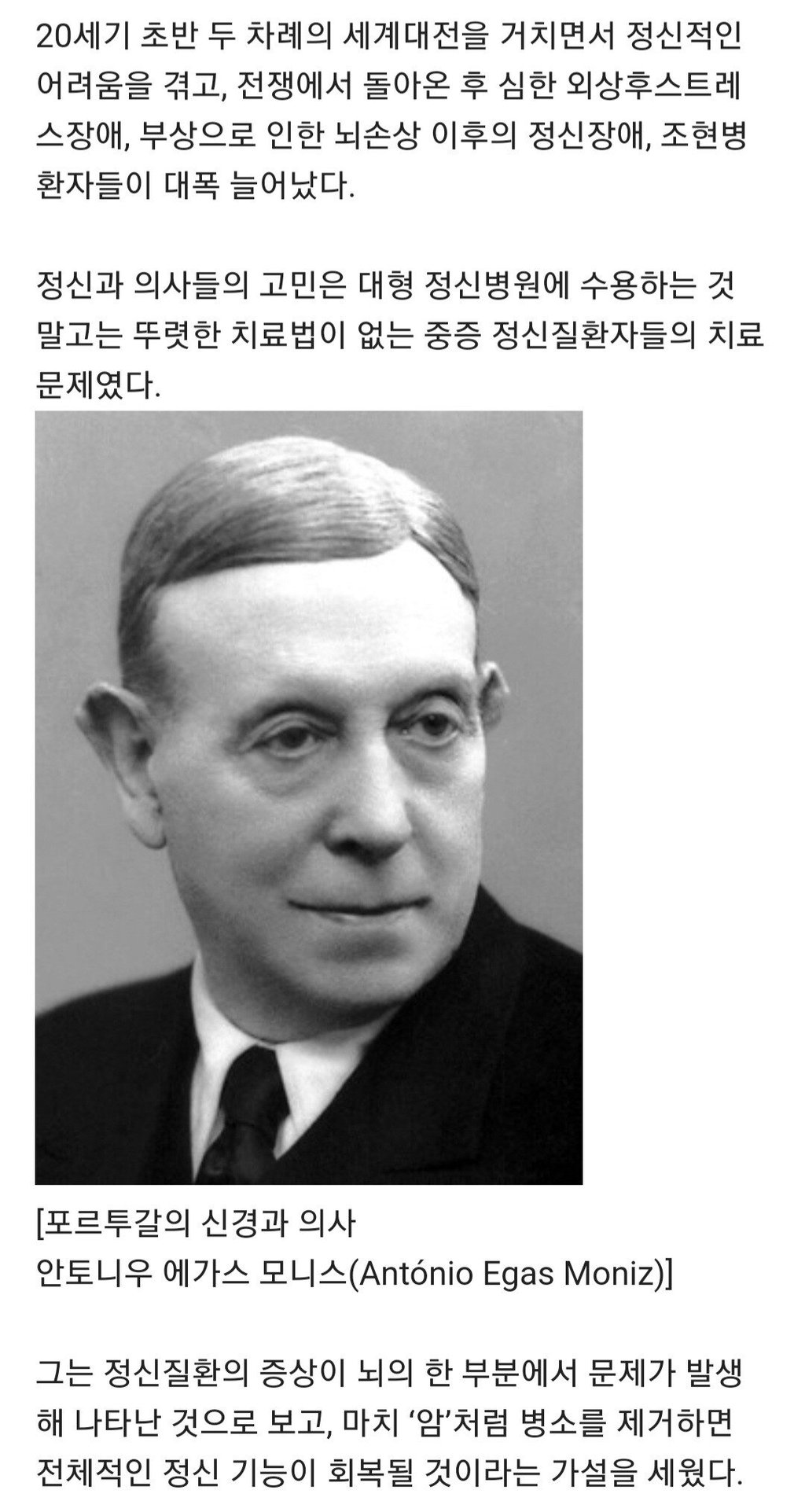 검증되지 않은 뇌 전두엽 제거 수술받은 케네디가 불행한 여인 3