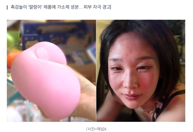 '이 장난감' 만졌다가 '얼굴 퉁퉁'... 급성 알레르기로 응급실행 1
