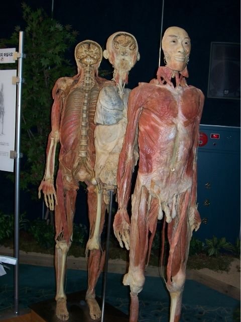 혐주의) 현대사회에선 절대 전시 불가능했을 전시전 ㄷㄷ 5