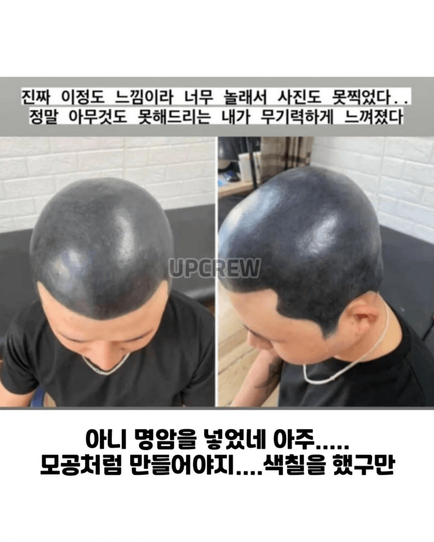 두피문신 대참사 1