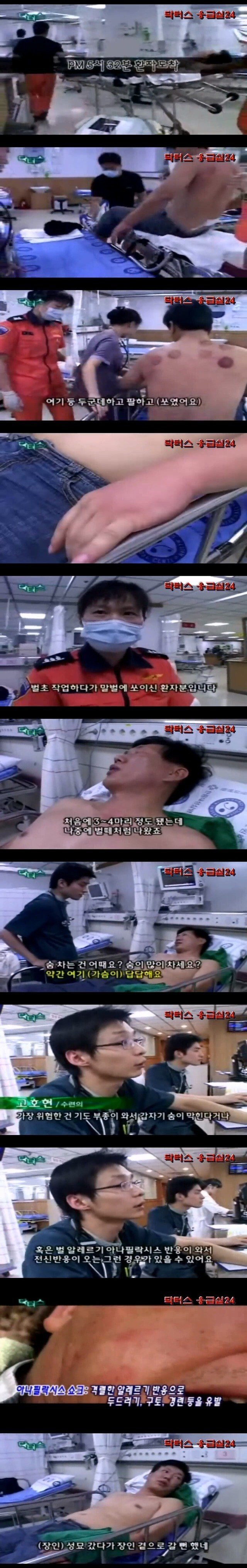 말벌에 쏘여서 응급실에 온 환자의 드립