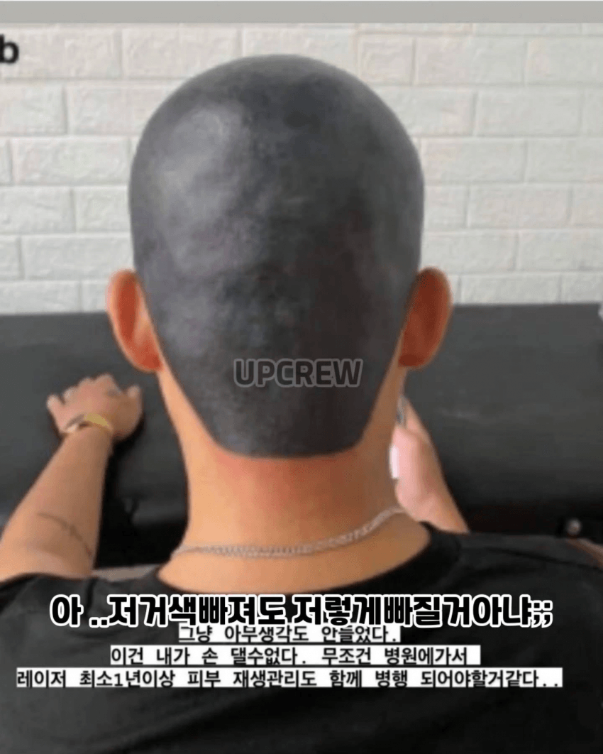 두피문신 대참사 2