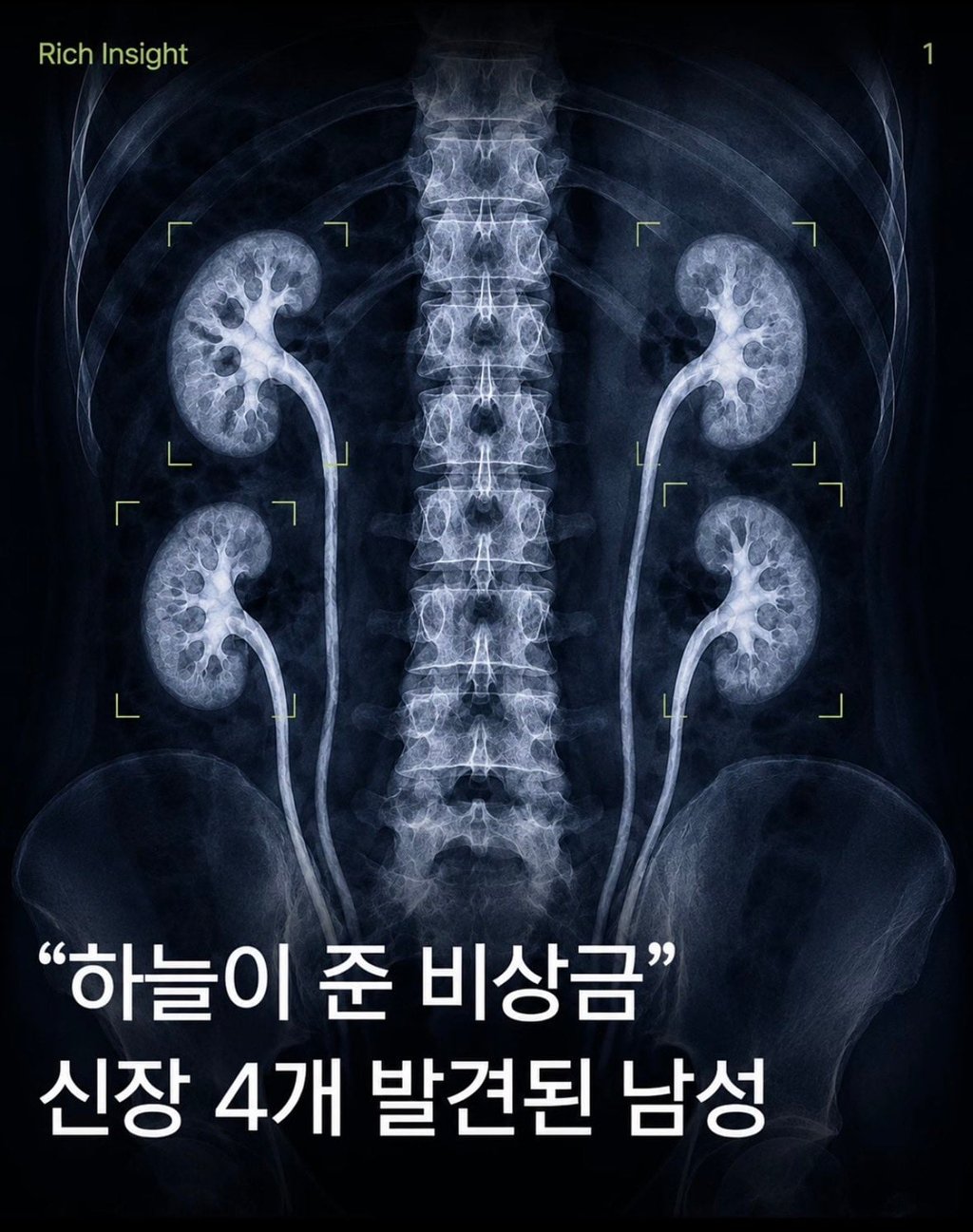 이새끼 비상금좆되네
