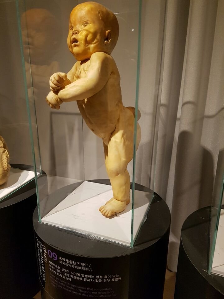 혐주의) 현대사회에선 절대 전시 불가능했을 전시전 ㄷㄷ 13