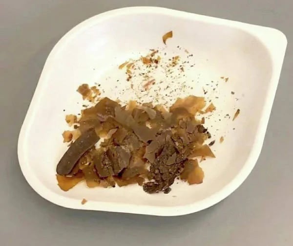 사람의 인분을 약으로 쓴 로마 의사들의 처방이 처음 입증되다 5
