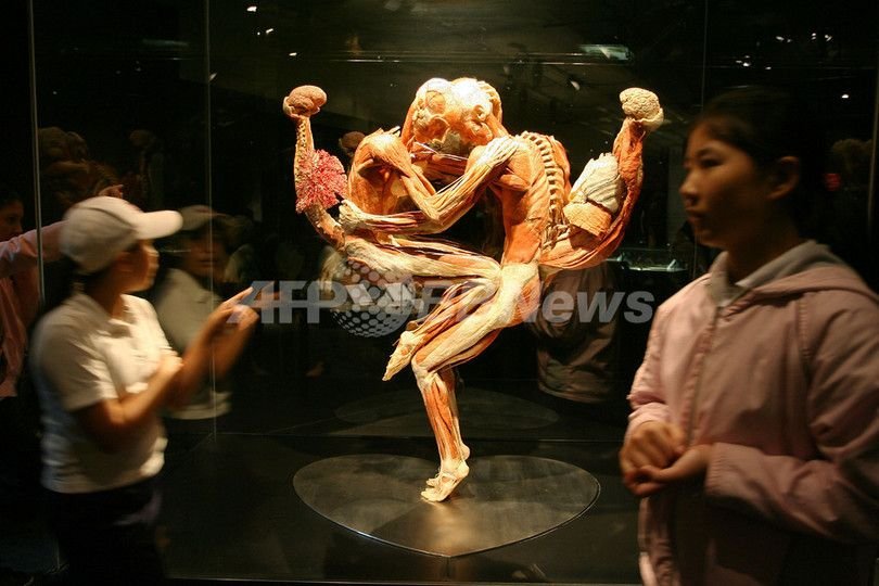 혐주의) 현대사회에선 절대 전시 불가능했을 전시전 ㄷㄷ 12