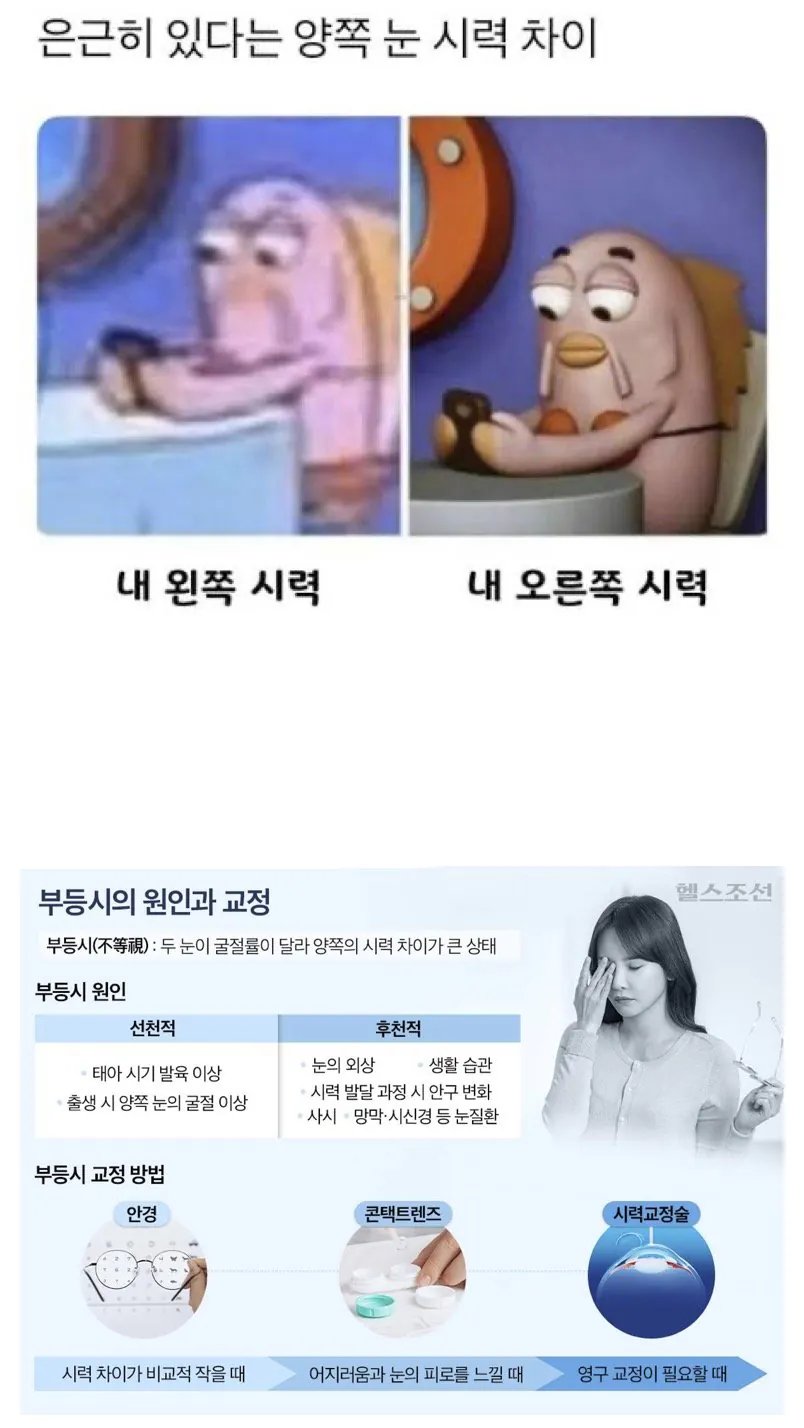 은근 많다는 양쪽 눈 시력차이